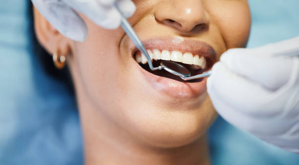 Best Emergency Cosmetic Dentistry (e.g., broken veneers) in Grandview, OK